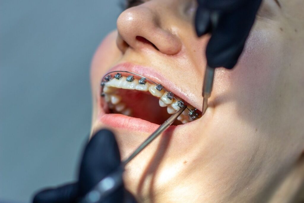 Ortodontik Tedavisi Bursa Konak Klinik